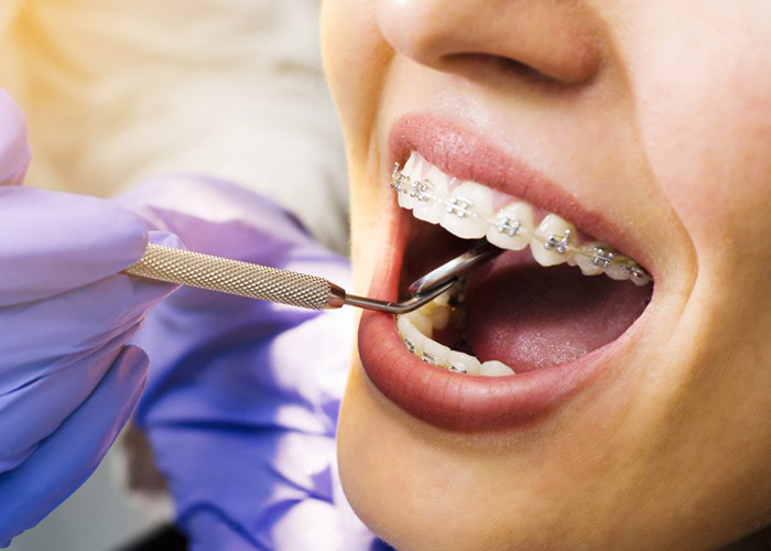 Orthodontics in Turkey